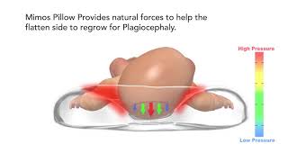 The Clinically Proven Effective Baby Pillow for Plagiocephaly Prevention and Treatment [upl. by Lleznol]