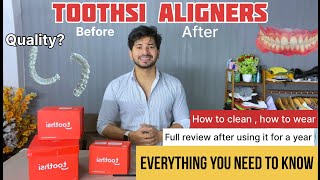 Toothsi Aligners Review And Unboxing 1 year experience  Everthing you need to know 1 [upl. by Haroved]