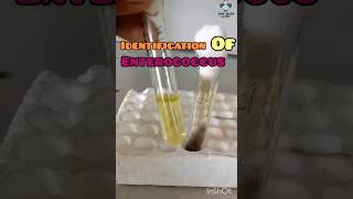 Identify Enterococcus Fecalis  Bile Esculin Agar  Catalase Test  GPC bacteriology microbiology [upl. by Goldin]