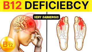 Top 10 Symptoms of Vitamin B12 Deficiency That You MUST Know ⚠️ [upl. by Ayvid]