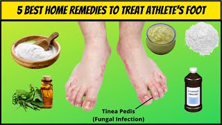 5 Best Natural Home Remedies For Athletes Foot  How To Get Rid of Athletes Foot Home Remedies [upl. by Yahsat]