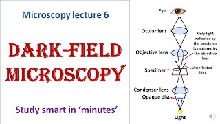 Darkfield microscope  working principle  Advantages disadvantages  Microscopy lecture 6 [upl. by Keli965]