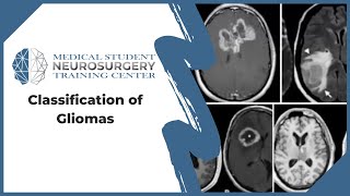 Classification of Gliomas [upl. by Norat]