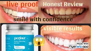 Perfora Teeth Whitening Powder  How to turn yellow teeths to white  shocking result honest review [upl. by Wrigley253]