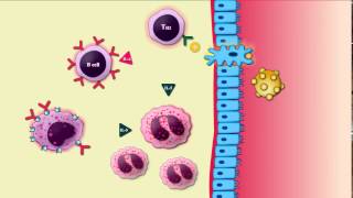 Asthma Pathogenesis Animation Part1sensitizationRobbins pathology [upl. by Euqor]