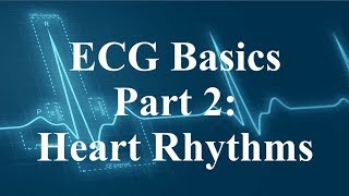 ECG Basics Part 2  Heart Rhythms [upl. by Sluiter]