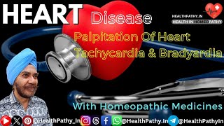 Heart Palpitations  Tachycardia amp Bradycardia [upl. by Lingwood]