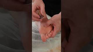 Deep tissue massage and moxibustion therapy for Evelin deeptissuemassage [upl. by Ayotahc]