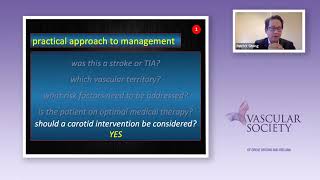 Carotid disease management  symptomatic and asymptomatic [upl. by Sesilu]