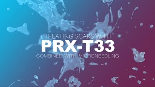 Treating Scars Combined With Microneedling  V Shavlak – PRXT33 Training Sessions – PART 2 [upl. by Annay]