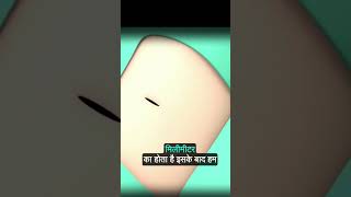 चलिए देखते हैं कैसे होती है हार्ट की एंजियोग्राफीAnimated Heart Angiography Procedure [upl. by Pepita35]