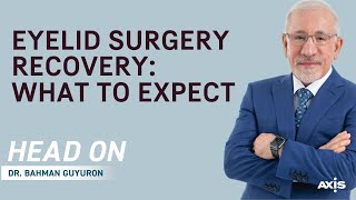 Eyelid Surgery Recovery What To Expect [upl. by Kciderf483]