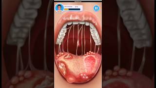 Treating a sore mouth asmr animation explore roblox pimplepopper games pimplepoping funny [upl. by Scammon303]