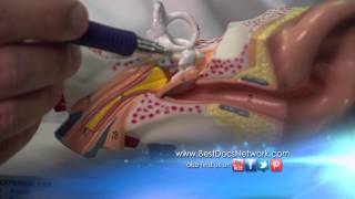 Middle Ear Reconstruction with Dallas Otologist Dr Yoav Hahn [upl. by Katlin]