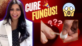 BEST TOENAIL FUNGUS TREATMENTS 2023 Treatments that ACTUALLY Work [upl. by Anifesoj805]