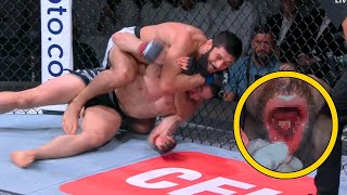 Khamzat Chimaev Shatters Robert Whittakers Jaw at UFC 308  Doctor Explains [upl. by Rebeca648]