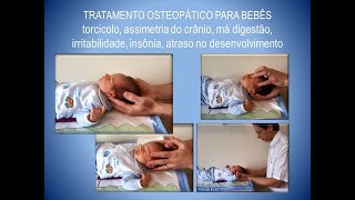 Bebê de 2 semanas Exame e tratamento pela Osteopatia craniossacral [upl. by Ury]