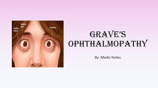 Graves ophthalmopathy pathophysiology  lid retraction Dalrymples sign diplopia proptosis etc [upl. by Thapa]