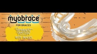 Myobrace for braces [upl. by Joshua]