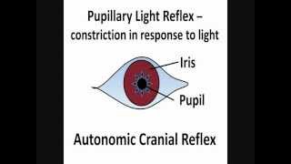 Pupillary Light Reflex  Cranial Nerves II amp III [upl. by Anthia]