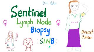 Sentinel Lymph Node Biopsy SLNB for Breast Cancer [upl. by Faustus]