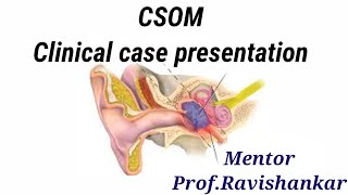 CSOM Clinical case presentation [upl. by Bluefield]