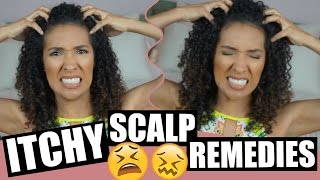 HOW TO TREAT AN ITCHY SCALP  RisasRizos [upl. by Collar]