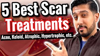 5 BEST Products for Scars  How to Get RID of Scars All Types [upl. by Dnaltiac28]