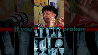 BROKEN BONE THEORY 😱 EP206 ​⁠jumpersjump [upl. by Nanfa161]