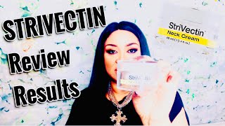 STRIVECTIN NECK CREAM REVIEW FINAL RESULTS [upl. by Stockmon984]