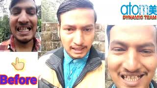 Atomy Toothpaste Testimony from Mr Raushan Jha Atomy Toothpaste Todays Self Test Atomy Toothbrus [upl. by Muhcan546]