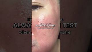 Always patch test patchtest skincare sensitiveskin skincaretips skincareroutine kbeauty [upl. by Pietro]