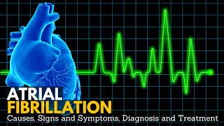 Atrial Fibrillation Causes Signs and Symptoms Diagnosis and Treatment [upl. by Akina]