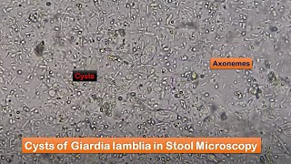 Giardia Cysts in stool Microscopy [upl. by Htrag762]