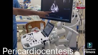 Pericardial effusion  massive Cardiomegaly how pericardiocentesis is done cardiology [upl. by Fletch120]