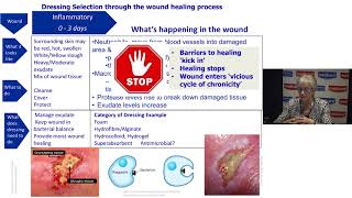 Understanding Wound Dressings Categories and Indications [upl. by Sremmus]