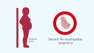 How Rh factor affects a pregnancy [upl. by Hammerskjold497]