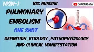 Pulmonary Embolism  part1 Bsc nursing semIII [upl. by Emia]