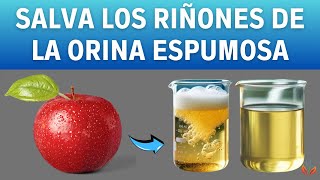 Realice Estos 5 Hábitos Todos Los Días Para DETENER LA PROTEINURIA  Vida Saludable [upl. by Stacee16]