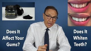 Benefits amp Risks of Activated Charcoal to Whiten Teeth Doctors Advice [upl. by Spanos]