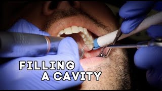 How Does A Dentist Fill A Cavity [upl. by Yeliab]