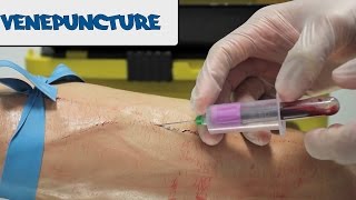 Venipuncture  How to take Blood  OSCE Guide old version  UKMLA  CPSA [upl. by Thagard]