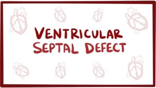 Ventricular septal defect VSD  repair causes symptoms amp pathology [upl. by Ramsden943]