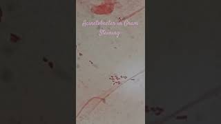 Gram negative bacteria in Gram Staining [upl. by Enylorac]