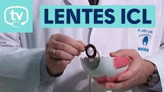 Lentes ICL una solución para corregir miopía hipermetropía y astigmatismo [upl. by Hacim715]