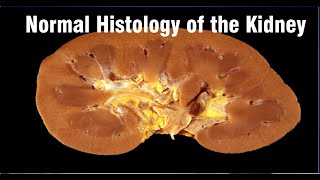 Normal Histology of the Kidney Dr OJAS GUPTA Pathology SGPGIMS Lucknow [upl. by Kristien]