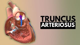 Truncus Arteriosus Causes Signs and Symptoms DIagnosis and Treatment [upl. by Tj]