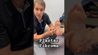 A plantar fibroma is a deposit of fibrous tissue in the medial plantar fascia physicaltherapy [upl. by Scholz353]