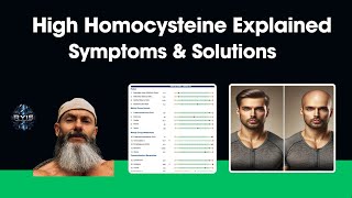 High Homocysteine Explained Hair loss Symptoms and Solutions [upl. by Jedthus]