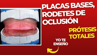 Placas bases rodetes de oclusión y contorno 👅 PASOS Prácticos ProtesisTotales [upl. by Lewse]